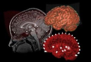 Mapa cerebral del placer de la mujer